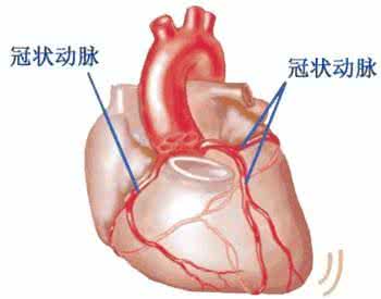 冠状动脉粥样硬化治疗 冠状动脉粥样硬化性心脏病怎么治-头条网