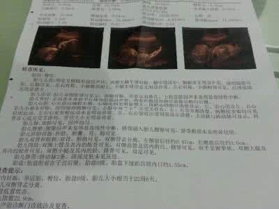 胎儿肾盂分离生下后果 胎儿肾盂分离 胎儿双肾分离有什么影响