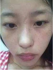 最有效的祛斑小秘方 5个祛斑小秘方 28天打造零斑点无暇肌