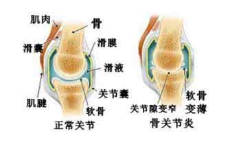 芍药先生 芍药先生61：膝关节退行性病变