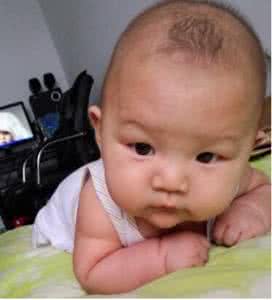 婴儿缺钙多久能补回来 婴儿缺钙多久能补回来 婴儿先天性缺钙怎么补？