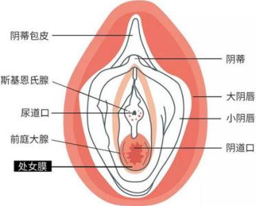 什么原因导致子宫壁厚 女性的处女膜厚是什么原因导致的