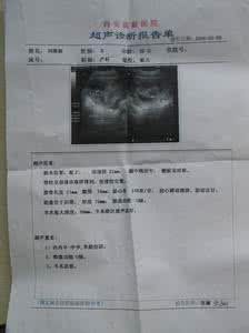入职前需要了解的事情 做B超前需要了解3件事