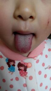 舌苔怎么看 宝宝舌苔怎么看 从舌苔看宝宝健康状况
