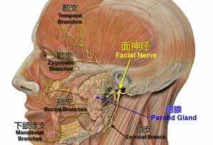 面神经麻痹 图文：面神经麻痹神方两剂见效