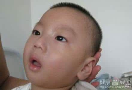 小儿发烧出疹子特征图 三岁左右小儿的语言特征