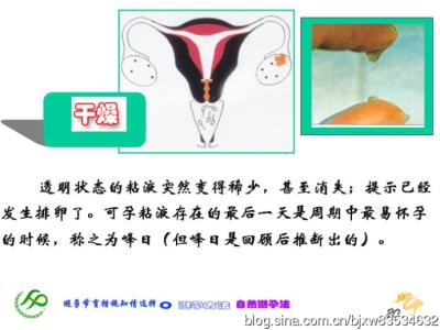 最安全有效的避孕方法 安全有效的避孕方法 安全有效的避孕方法有哪些