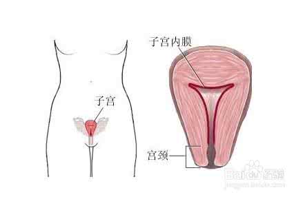 治疗女性子宫内膜薄 女性子宫内膜症与洗发精有关