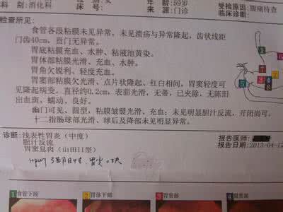 胃病怎么检查 胃病怎么检查 如何正确检查胃病