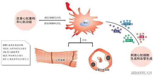 干细胞移植治疗糖尿病 糖尿病干细胞移植 干细胞移植有哪些特点