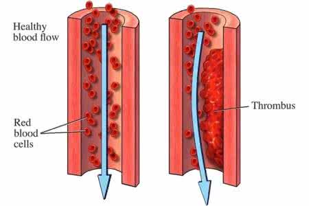 通血管的古方 一张图告诉你一个通血管的特效古方