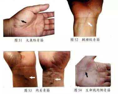 习惯性便秘者多是脾虚