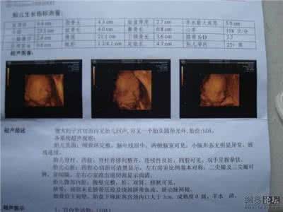 三维彩超是检查什么的 三维彩超检查的优点