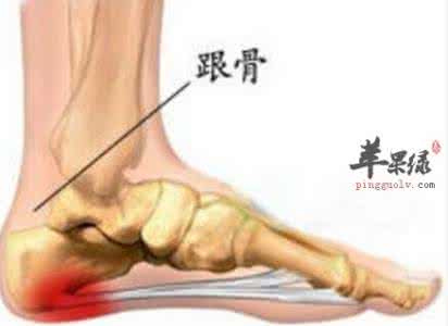 足跟痛治疗最管用偏方 治足跟痛秘方5则*