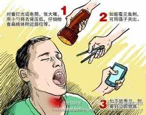 鱼刺卡在喉咙怎么办 鱼刺卡在喉咙怎么办呢