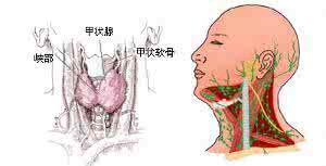 桥本氏甲状腺炎病因 桥本式甲状腺炎 它的病因是什么