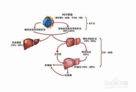 引起肝功能异常的原因 肝功能异常怎么治疗