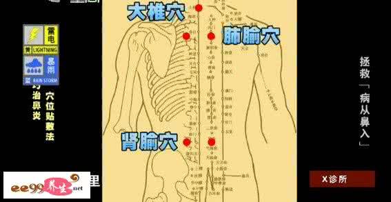 郭裕兰 X诊所20150626视频和笔记:郭裕,鼻炎,穴位贴敷疗法,穴位注射疗法