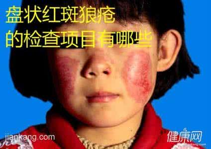 红斑狼疮能吃甲鱼 什么是盘状红斑狼疮