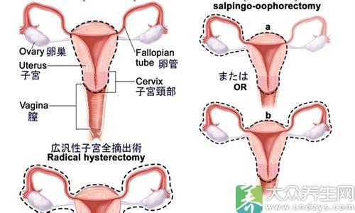 子宫肌瘤引起的原因 子宫肌瘤怎么引起的？一般是哪些原因？