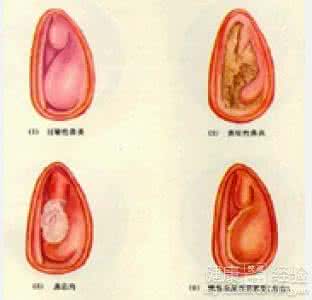 鼻窦炎的最好治疗方法 周尔晋周老的几种常见鼻炎治疗方法-人体内药疗法