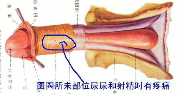 为什么射精时有疼痛感 射精时阴茎疼痛感怎么消除