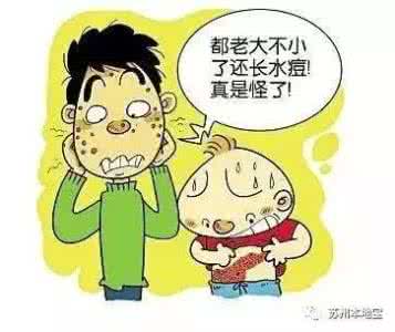 出水痘是好事吗 出水痘要注意什么?水痘要注意的10件事
