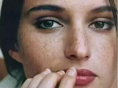 老中医祛斑 老中医祛斑 中医祛斑有面子不留痕