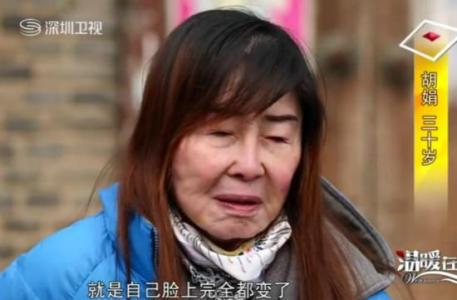 胡娟恢复容貌2017图片 胡娟恢复容貌后的样子 你的容貌，正是你赋予生活的样子