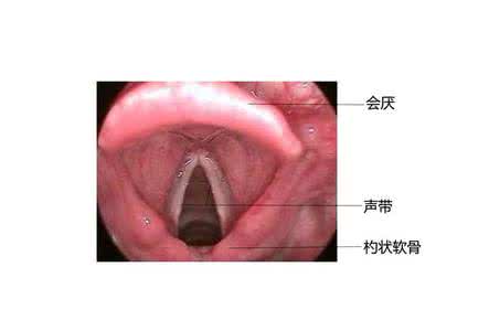 声带麻痹中医治疗 声带麻痹 手术后声带麻痹怎么办？