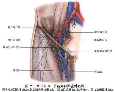 腹股沟淋巴结怎么治 腹股沟淋巴结 食疗治腹股沟淋巴结肿大