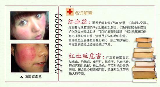 敏感肌肤如何祛痘 祛痘印最好的方法是什么 敏感肌肤可以用吗