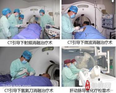 肝癌介入治疗 肝癌介入治疗如何操作 治疗时要注意什么