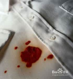 白衣服铁锈怎么洗掉 衣服 铁锈 怎么洗掉铁锈? 精