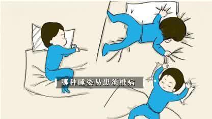 脊椎神经损伤 脊椎损伤 八大生活方式是凶手