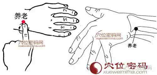 急性腰扭伤针灸 急性腰扭伤针灸穴位 鱼际穴针刺治疗急性腰扭伤一例