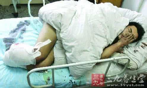 男子双手断掌 男子双手被轧断 截肢后的护理方法