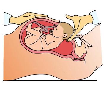 预产期发生宫缩怎么办 发生宫缩怎么办