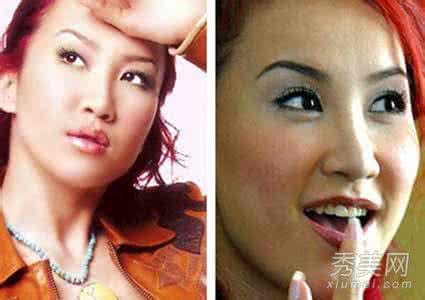 割双眼皮失败的明星 割双眼皮的最佳年龄 割双眼皮失败的明星