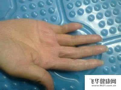 手指脱皮 手指脱皮 你还在为手指脱皮而烦恼吗