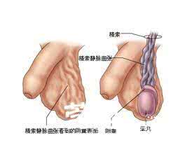 有效决策的七个步骤 教你七个步骤自己有效治疗早泄