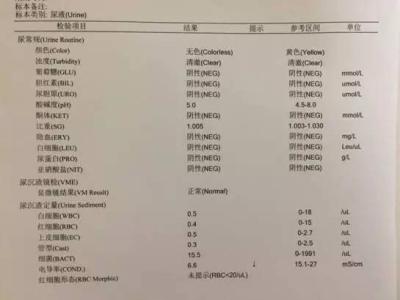 香港大学深圳医院 简单教你读懂尿常规 | 香港大学深圳医院肾内科
