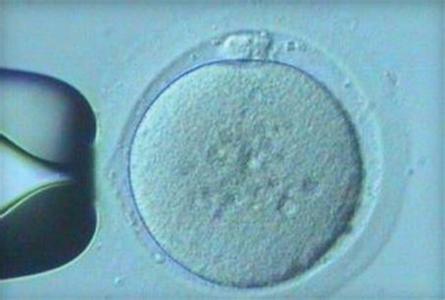 卵泡太大排不出来怎么办 卵子什么时候排出体外