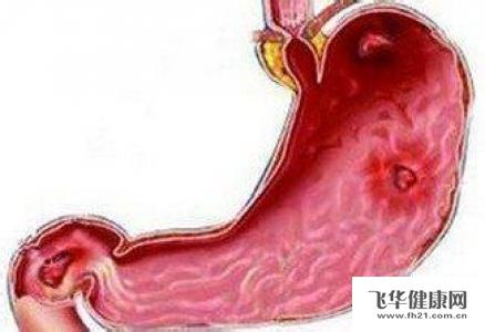 黑便的原因有哪些 消化道出血的症状