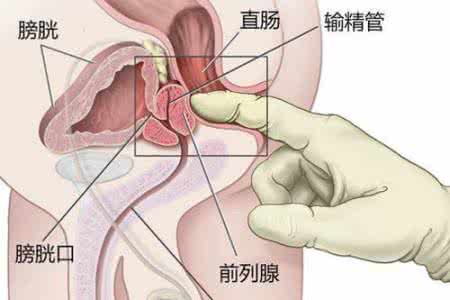 哪些坏习惯会损害前列腺？