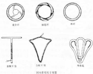 上环是什么样子的图片 上环是什么意思