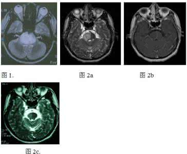 中枢神经系统解剖学 《中枢神经系统CT和MRI鉴别诊断学》