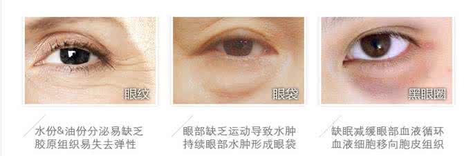 黑眼圈眼袋怎么办 怎么去黑眼圈和眼袋 怎么去黑眼圈和眼袋 黑眼圈的预防及治疗