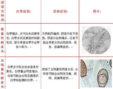 滴虫性阴炎早期症状 滴虫性阴道炎用药 滴虫性阴道炎用药话你知