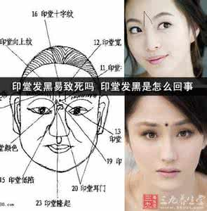 印堂发黑是怎么回事 印堂发黑易致死吗 印堂发黑是怎么回事